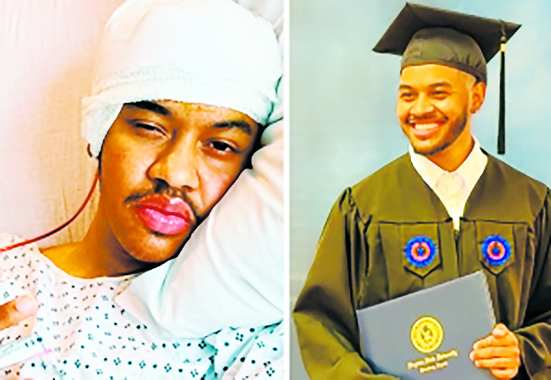 VSU Student Transitions From Coma Patient To A College Grad